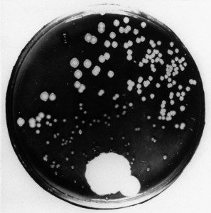 A photograph of Fleming’s petri dish